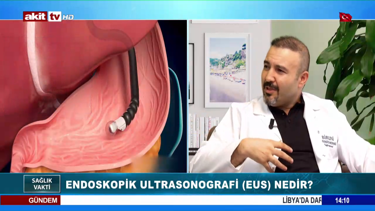 Endoskopik Ultrasonografi Eus Nedir